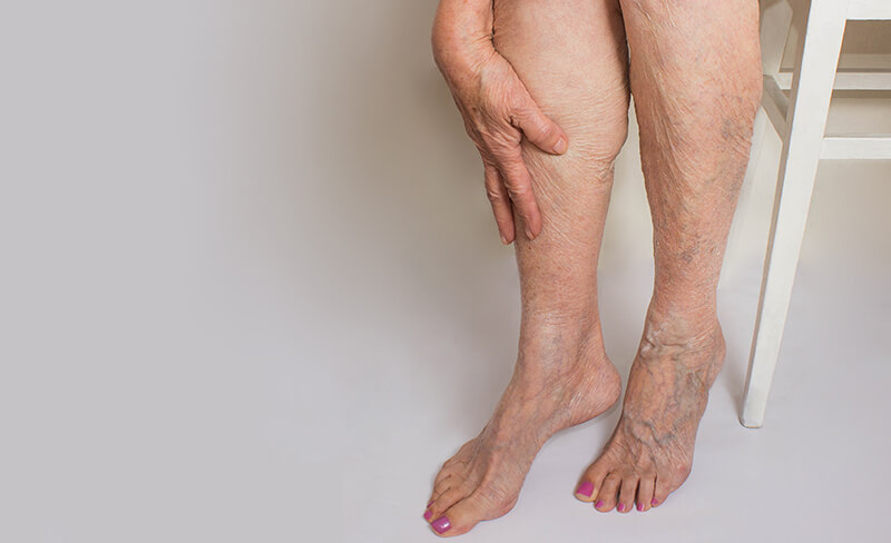 Woman's legs with hand