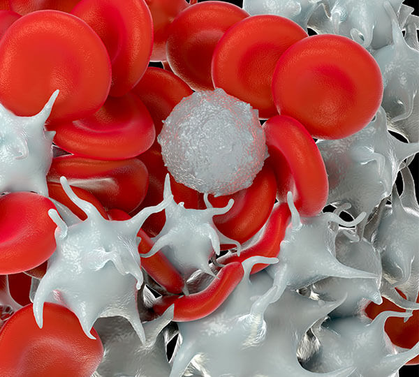A blockage of platelets