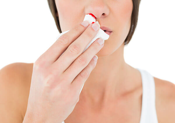 Woman dabbing nosebleed